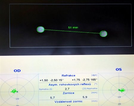 screeningové vyšetření zraku plusoptix velké meziříčí vysočina děti